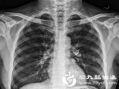 非感染性胸膜炎的病因较为复杂