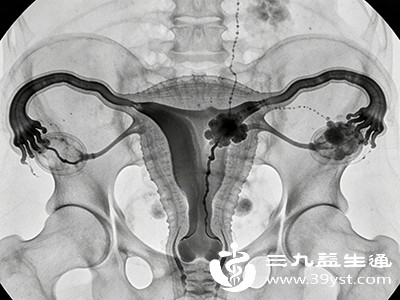 检查前，患者需要告知医生自己的病史，包括过敏史、既往疾病史等