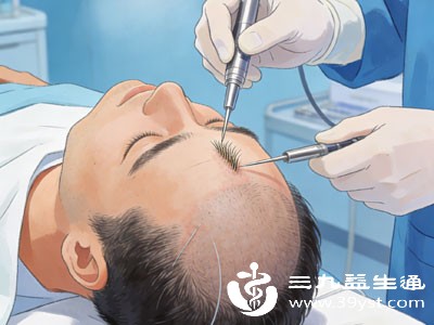 对于雄激素性脱发患者