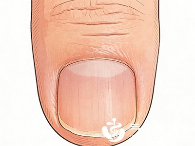 激素水平的波动会影响指甲细胞的生长和代谢，导致指甲形态改变。