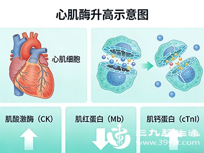 心力衰竭 心力衰竭