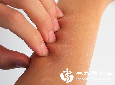 有一种特殊类型叫做无疹型带状疱疹，患者只表现为局部皮肤的疼痛，却没有红斑和水疱出现