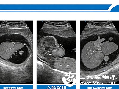 心脏及血管彩超一般无需空腹