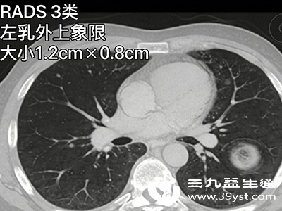 例如甲状腺、乳腺彩超，这些部位远离胃肠道，检查时不会受到进食的影响，无需空腹