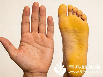 部分血液系统疾病也会造成手心脚心发黄