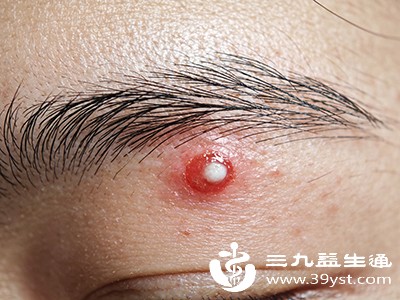 激素水平变化 激素水平变化