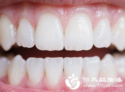 牙周炎是由于牙菌斑、牙结石等刺激牙周组织引发的炎症 牙周炎是由于牙菌斑、牙结石等刺激牙周组织引发的炎症