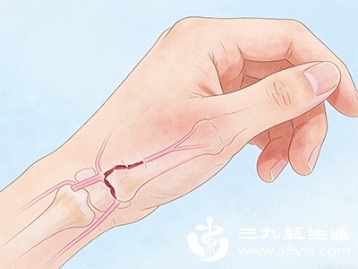 对于多数手筋完全断裂，或是部分断裂却难以自愈的情况，手术治疗是常见且关键的手段