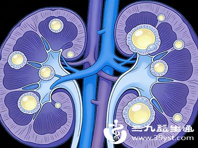 部分多发性囊肿与遗传相关，比如多囊肾、多囊肝，往往家族中会有类似病例