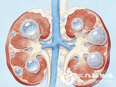 若囊肿破裂，会突发剧烈腹痛；若合并感染，可能出现发热、寒战。
