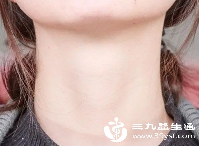 嗓子闹干旱 这些原因让你的喉咙喊救命