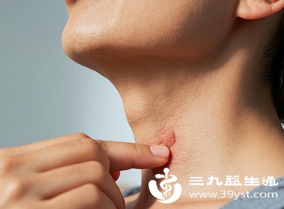 烧心、反酸、咽喉疼痛