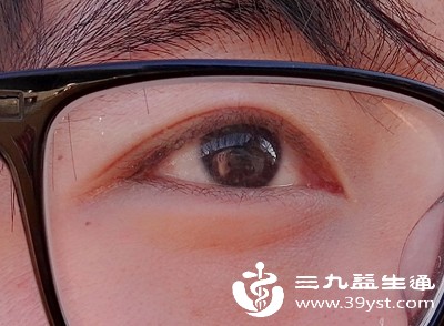 眼部感染如结膜炎、麦粒肿等，炎症刺激会致使眼皮红肿