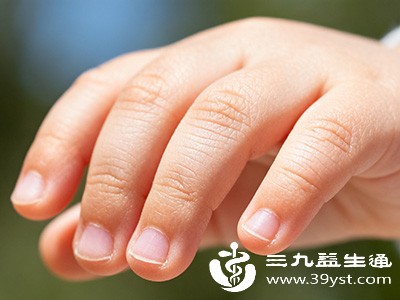 某些皮肤疾病也可能引发手上长倒刺的症状 某些皮肤疾病也可能引发手上长倒刺的症状