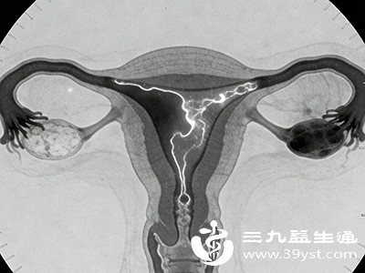 如果发现输卵管堵塞后一味等待自愈,可能错过最佳治疗时机,带来更多风险 如果发现输卵管堵塞后一味等待自愈,可能错过最佳治疗时机,带来更多风险