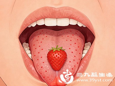 这是一种好发于儿童的急性发热出疹性疾病,草莓舌是其典型症状之一 这是一种好发于儿童的急性发热出疹性疾病,草莓舌是其典型症状之一