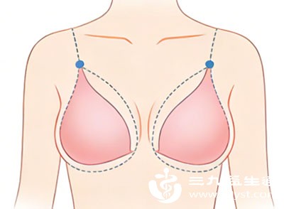 对于乳房大小差异较为明显