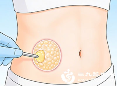 自体脂肪填充也是改善乳房大小差异