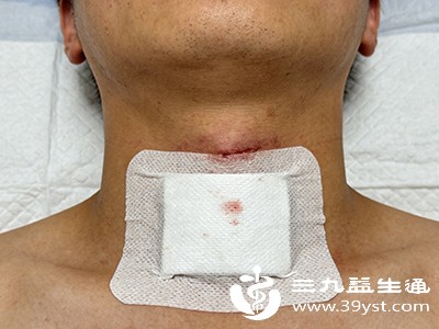 有压迫症状的良性大结节：需手术切除