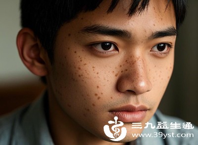 告别色斑困扰 重拾净透肌肤——有效淡斑的实用指南