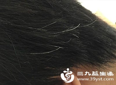 别再乱拔白发啦 医生说这样做才对很多人都做错了