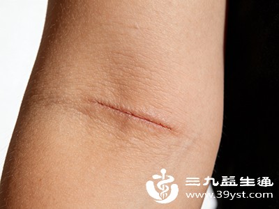 手术疤痕太显眼 分阶段修复方法来了从早期到后期全覆盖