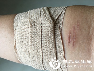 压力治疗 压力治疗