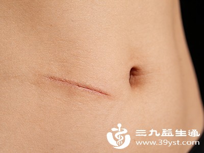 保持疤痕部位清洁干燥,避免沾水感染,遵医嘱定期换药 保持疤痕部位清洁干燥,避免沾水感染,遵医嘱定期换药