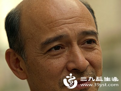 头发秃顶别慌 从成因到治疗全解析这些方法或许能帮到你