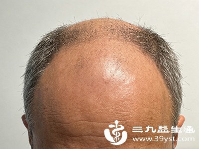 除了类型和治疗方法，还有一些因素会影响秃顶的治疗效果