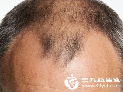 治疗需要耐心和坚持