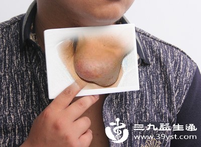 慢性消耗性疾病如糖尿病、慢性肾病、肝硬化、恶性肿瘤等,会使机体免疫力下降,对病原体的抵抗力减弱 慢性消耗性疾病如糖尿病、慢性肾病、肝硬化、恶性肿瘤等,会使机体免疫力下降,对病原体的抵抗力减弱