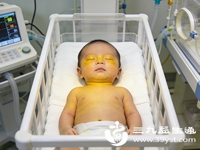 婴儿黄疸高危害大 类型影响应对全解析 新手爸妈必看