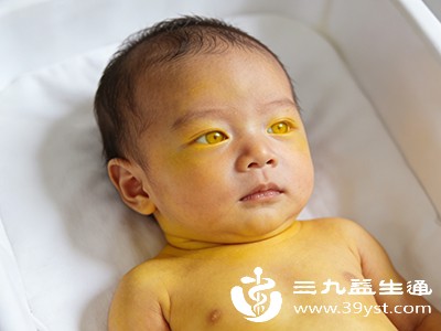 如果黄疸持续升高且未得到及时处理，可能会导致宝宝出现食欲不振、精神萎靡、嗜睡等症状