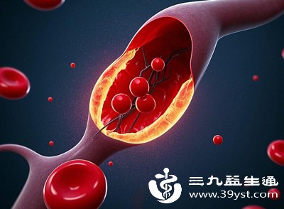 血浆脂蛋白不是“一刀切” 4类功能大不同分清好坏 轻松做好血脂养护 新手零门槛！