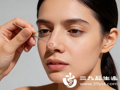 告别草莓鼻不难 每天5分钟简单2招让黑头慢慢变少