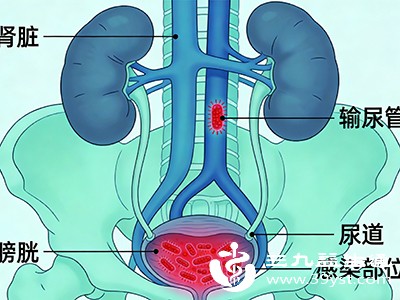 泌尿系统的器质性病变 泌尿系统的器质性病变
