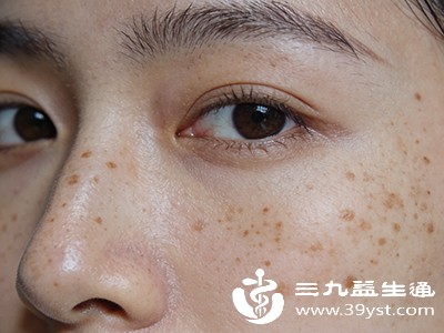 别轻信“快速祛斑”产品