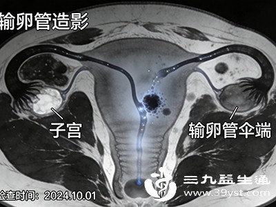 剩余输卵管的健康状态