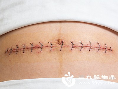 生完娃（剖腹产版） 坐月子可不是躺平 这样做恢复更省心