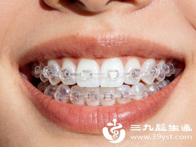 传统正畸适合门牙大且伴随牙齿排列不齐、门牙前突的人群，通过佩戴托槽矫正器，逐步调整门牙位置，拉近与邻牙的比例，同时改善牙齿咬合关系