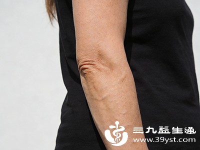 别让蝴蝶袖拉低颜值 科学方法教你瘦手臂 赶紧动起来