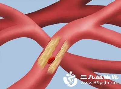 人体各器官的正常运转都离不开氧气,而红细胞是氧气的“搬运工”,促红素通过调控红细胞数量,间接决定了血液的携氧效率 人体各器官的正常运转都离不开氧气,而红细胞是氧气的“搬运工”,促红素通过调控红细胞数量,间接决定了血液的携氧效率