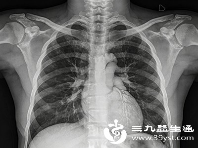 胸透后想备孕 别急这个时间点要记牢 男女有差异