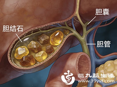 。胆囊炎、胆结石患者由于胆汁排泄不畅，夜间睡眠时胆汁可能逆流进入胃肠道，进而影响口腔，产生口苦