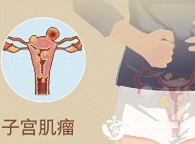 子宫肌瘤(尤其是黏膜下肌瘤)会影响子宫收缩,导致经期延长或出血频繁 子宫肌瘤(尤其是黏膜下肌瘤)会影响子宫收缩,导致经期延长或出血频繁