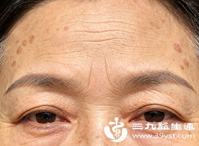 科学淡化色斑 从根源到方法的全面指南