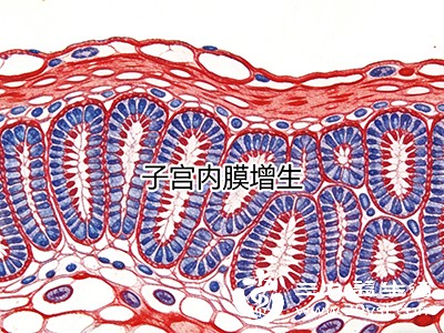 长期无排卵使子宫内膜持续受雌激素刺激,缺乏孕激素对抗,可能增加子宫内膜增生、息肉甚至癌变的风险 长期无排卵使子宫内膜持续受雌激素刺激,缺乏孕激素对抗,可能增加子宫内膜增生、息肉甚至癌变的风险