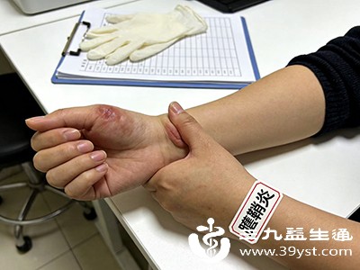 炎症缓解后，进行患病部位的拉伸练习