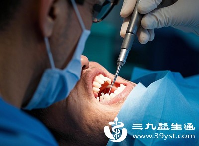 别盲目一次性拔智齿 分清利弊 根据智齿难度选对方式 省时又安全